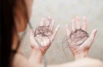 想早日告别脱发?请收好这份日常防脱攻略 图片-1