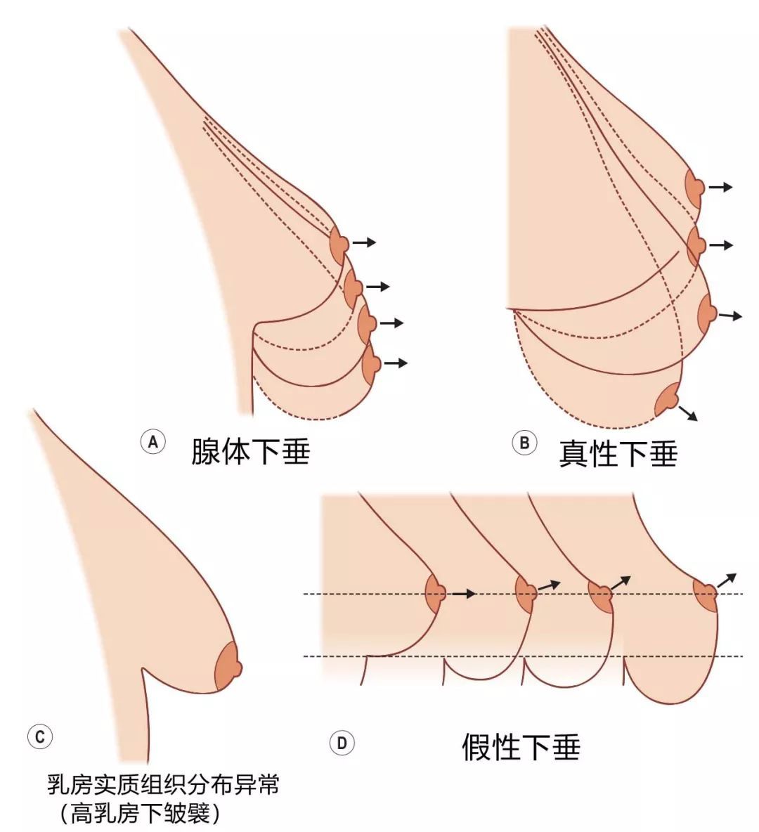 大小并不决定一切，胸型美才是真的美 图片-11