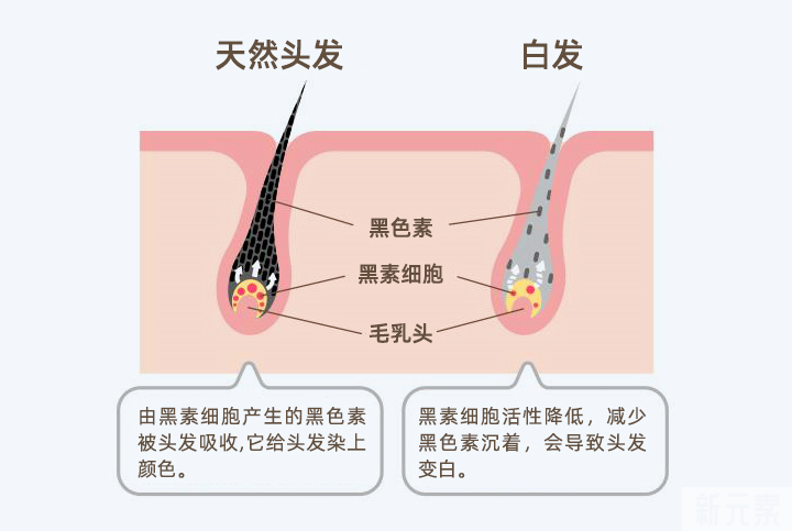 白发可以提前预防吗? 图片-2