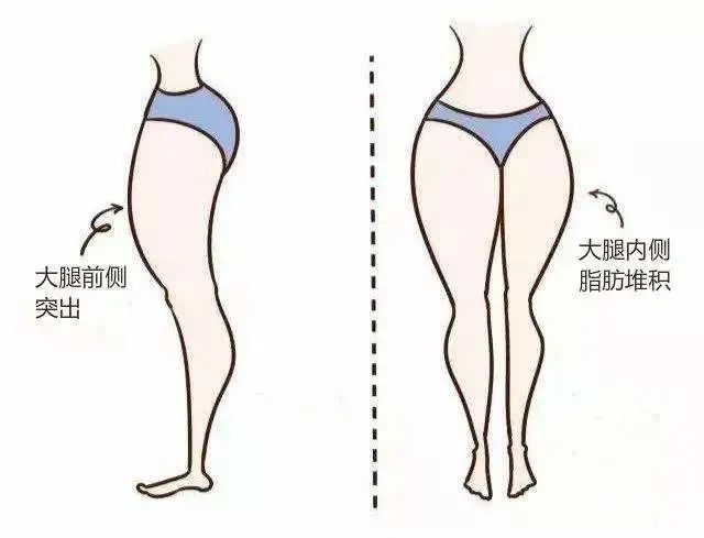 哪个部位做吸脂，效果会更好? 图片-4
