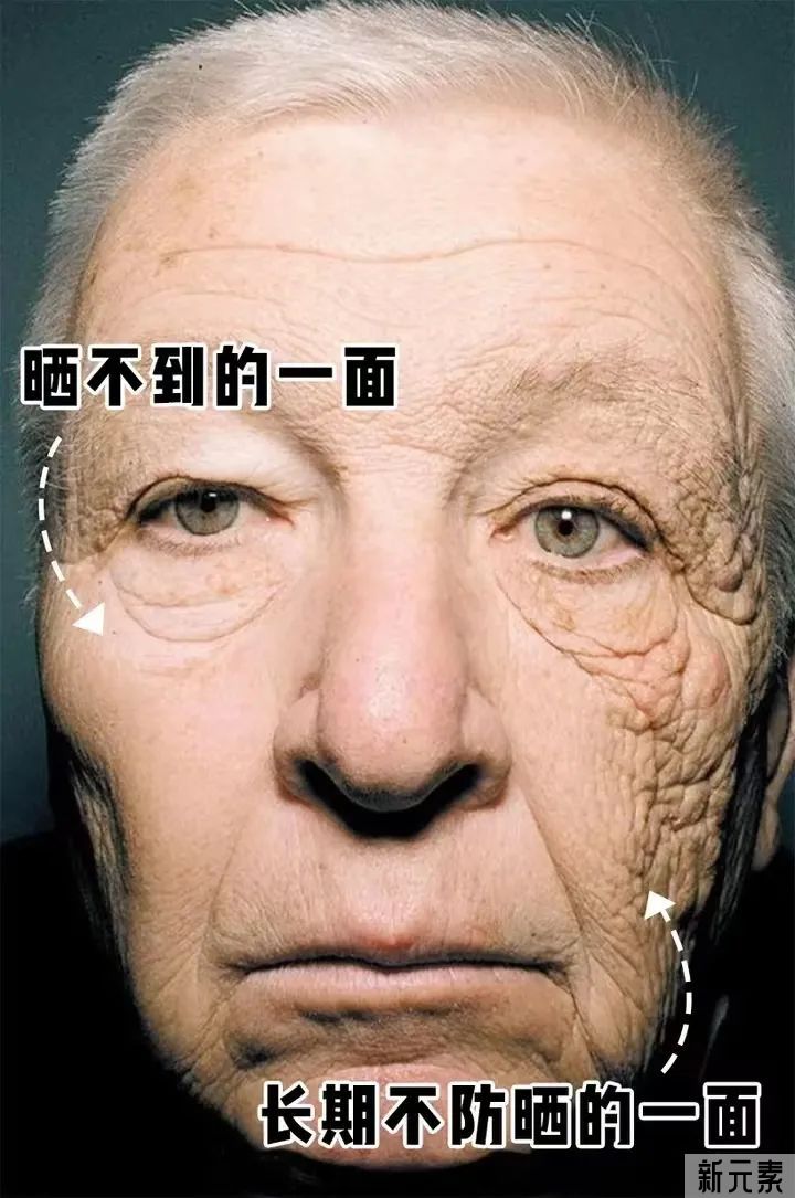 干货 | 看完这篇你就会知道，变白有啥难的? 图片-6