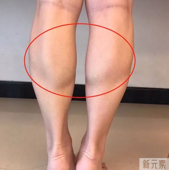 大肥腿小壮腿，想要瘦下来，这个关键点不能忽略 图片-6