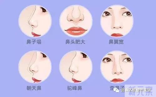 隆鼻术后应该要怎么护理呢~ 图片-2