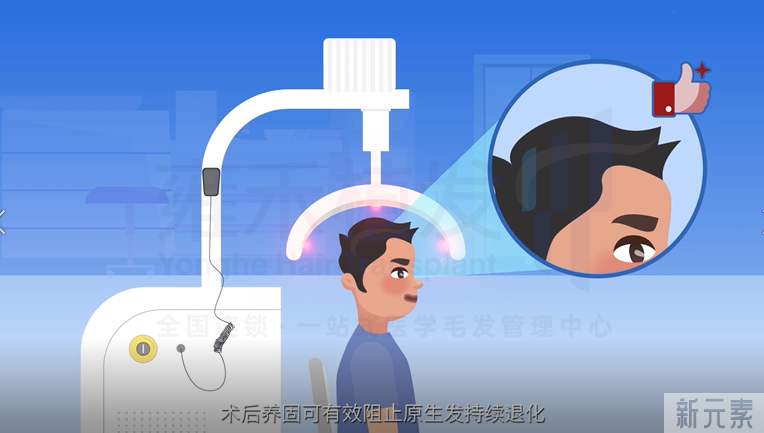 植发后，4种方法让头发长得快、长得好! 图片-3