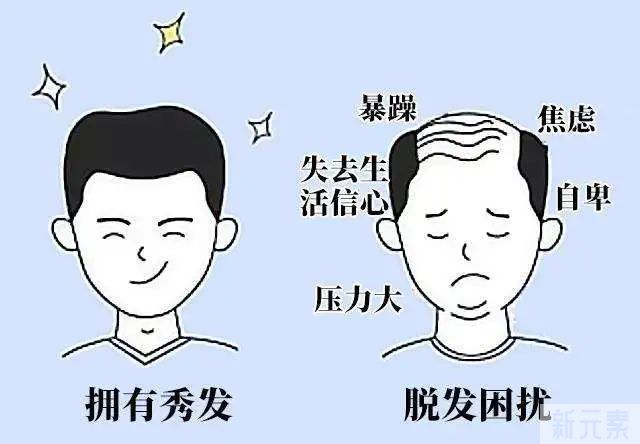 年纪轻轻经常脱发?可能是因为这些! 图片-5