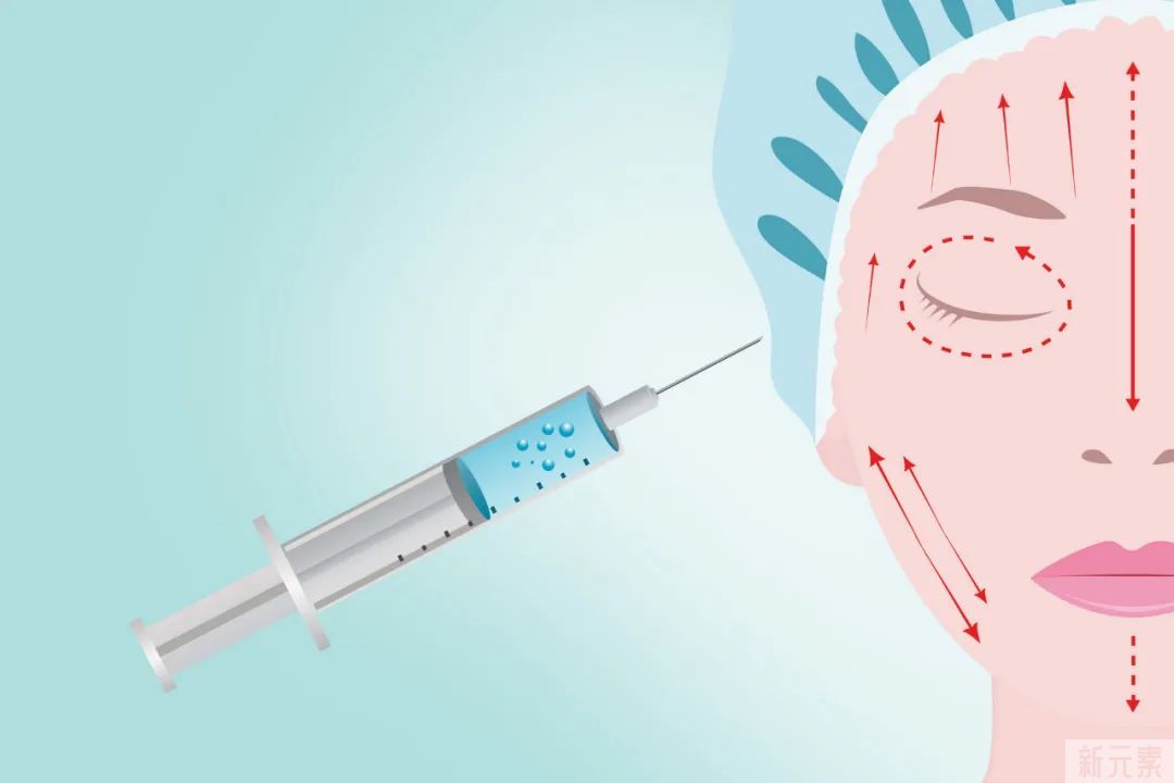 一次手术解决四大“面子”问题，自体脂肪面部填充你了解多少? 图片-10