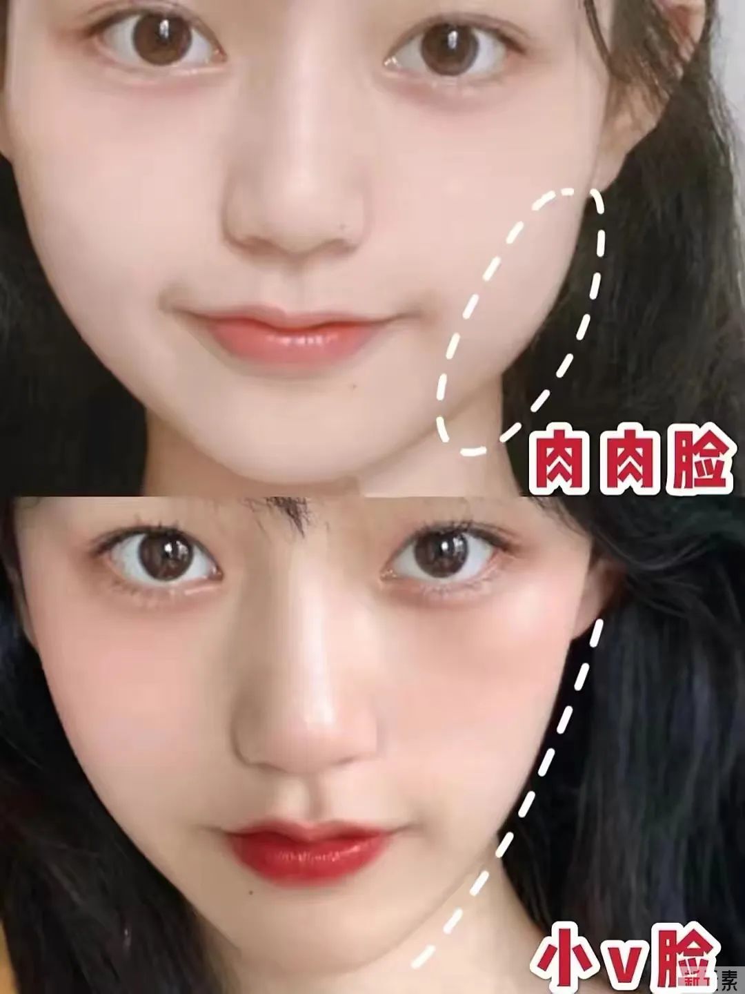 不是所有大脸都适合打瘦脸针! 图片-7