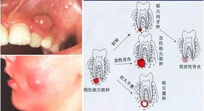 这些不起眼的小症状，竟能“侵蚀”一口好牙? 图片-4