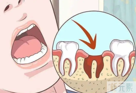 口腔科普 | 牙齿咬合有问题为什么一定要做矫正?牙齿咬合不好有什么影响? 图片-4
