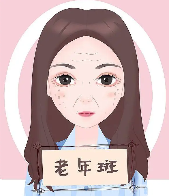 长斑的原因和类型都不清楚，还说什么有效祛斑? 图片-6