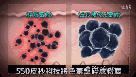 长斑的原因和类型都不清楚，还说什么有效祛斑? 图片-13