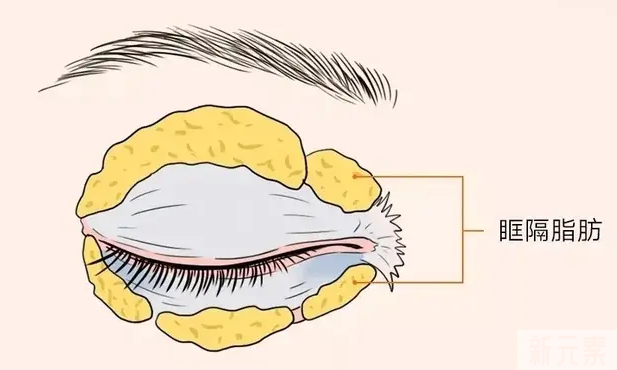 眼部衰老，你在哪个级别? 图片-6
