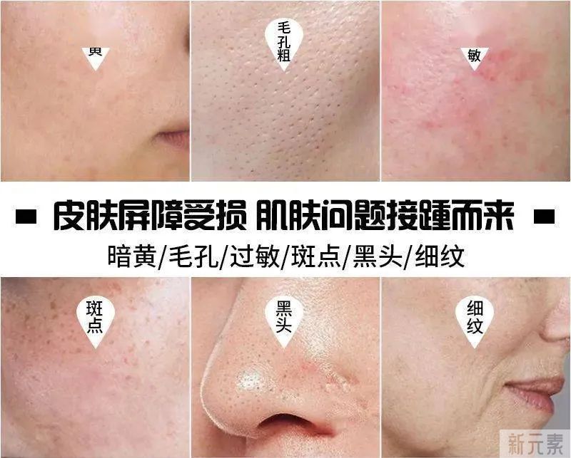 科普知识分享:关于皮肤屏障受损 图片-6