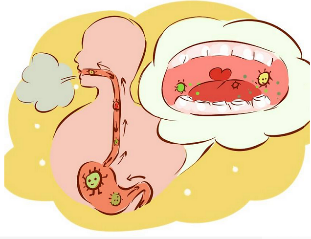 牙菌斑:细菌在口腔内开“派对”，你竟毫不知情! 图片-5