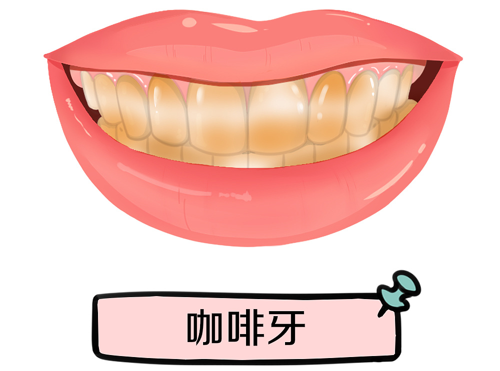 柠檬美白牙齿靠谱么? 图片-7