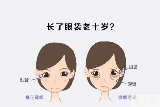 年轻人和中年人祛眼袋区别这么大?看完省了不少钱! 图片-2