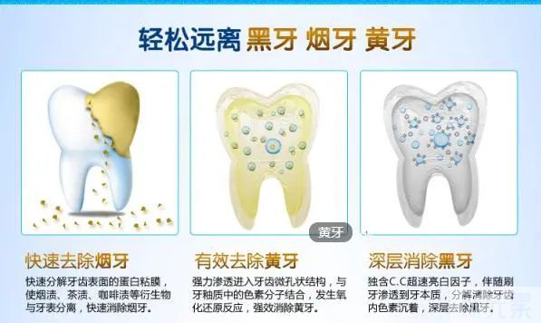 牙齿为什么会变黄?这个小妙招让你牙齿白白~ 图片-6