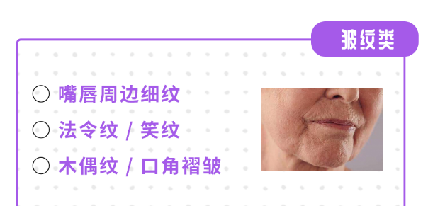 不容忽视的口周抗衰! 图片-2