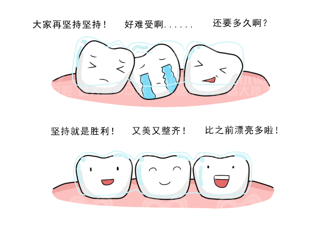 儿童早期矫治可以戴隐形牙套吗? 图片-2