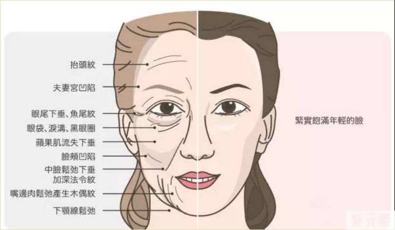 少女针横空出世，和传统玻尿酸到底区别在哪? 图片-7
