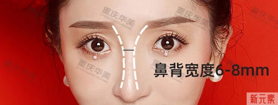 先别忙着隆鼻，你的鼻子也许只是“伪塌鼻” 图片-5