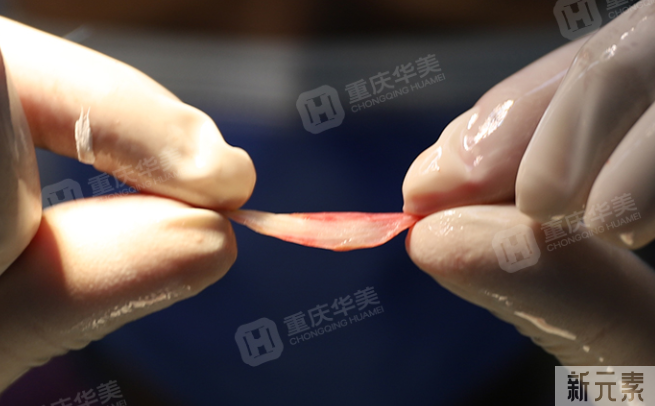 先别忙着隆鼻，你的鼻子也许只是“伪塌鼻” 图片-7