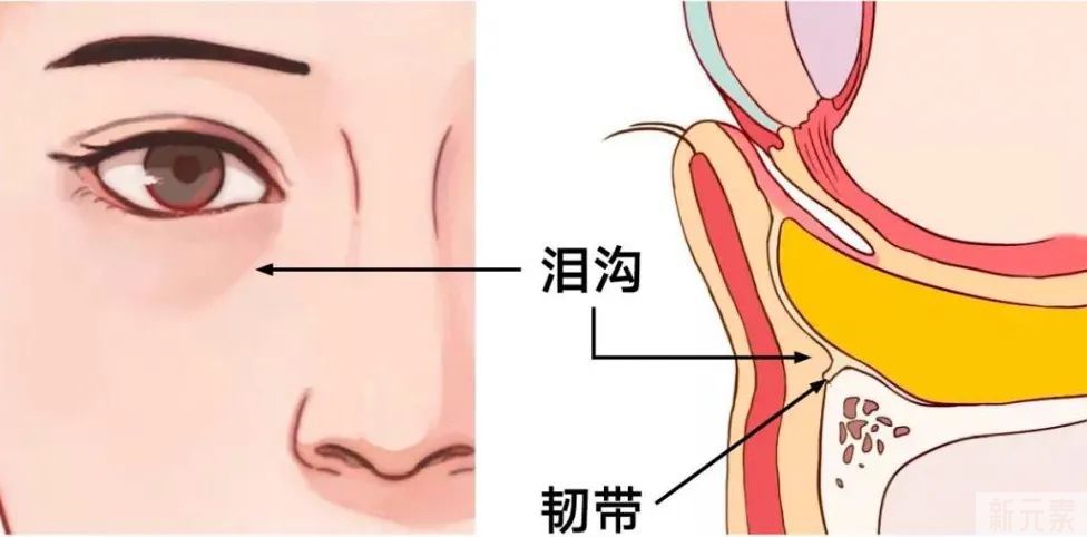 讲真!做祛眼袋手术时，千万不能省这个钱 图片-5
