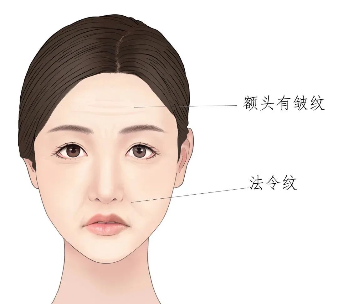 面部凹陷怎么办?手把手教你，速来围观! 图片-4