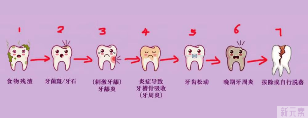 矫正会导致牙齿变松吗?别让谣言动摇了你 图片-6