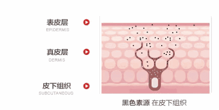 想要夏季祛斑不反黑，这些功课务必得做足!! 图片-5