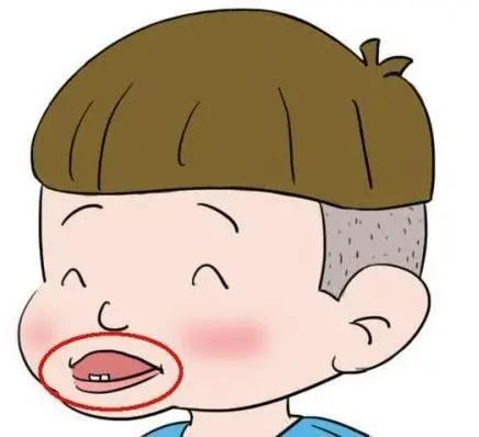 科普来了 | 爸妈必看!乳牙换恒牙 前后注意啥? 图片-8