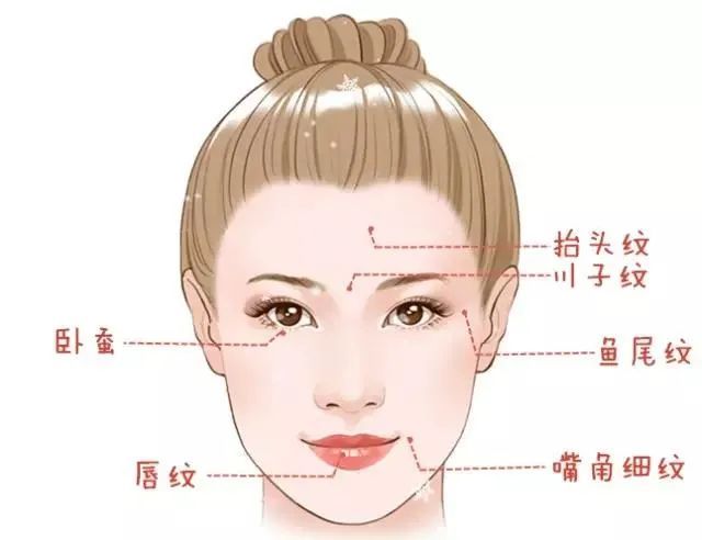 玻尿酸品牌那么多，哪个填充效果好?不同部位如何选择玻尿酸? 图片-7