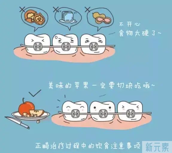 矫治过程中，托槽掉了怎么办? ! 图片-9