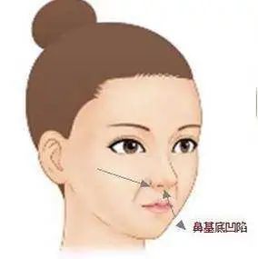 科普 | 嘴凸要如何改善? 图片-7