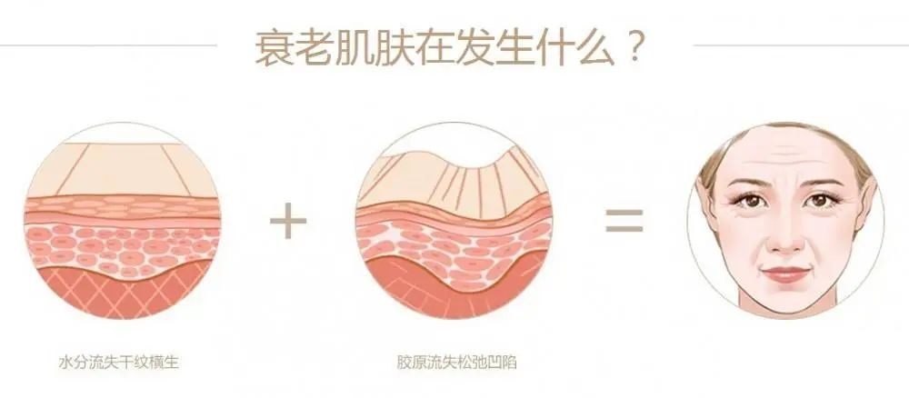 国产除皱和进口除皱有什么区别? 图片-4
