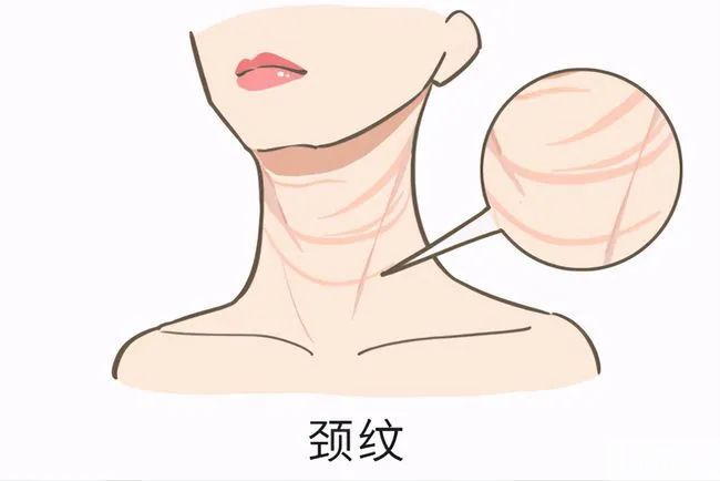 颈纹尤其偏爱这3类人群，显老又难搞定，如何淡化? 图片-3