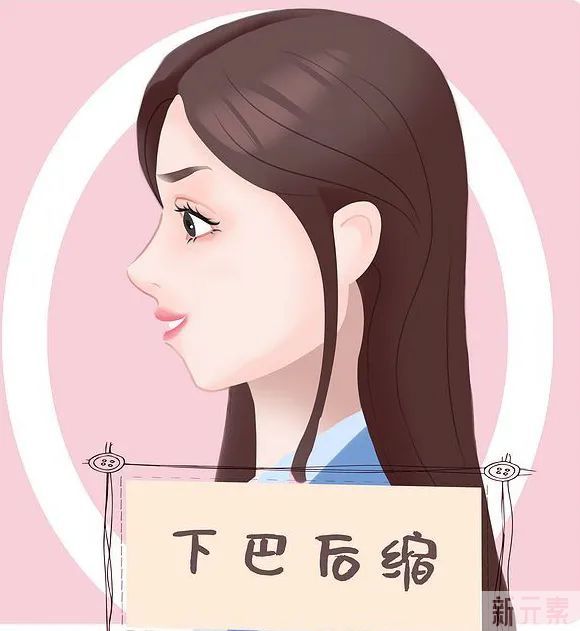 下巴短小、下巴后缩，玻尿酸和手术改善哪个更好? 图片-4
