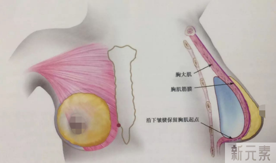 哪个年龄段适合做假体隆胸?如何才能大的自然?do胸前先看这一篇! 图片-7