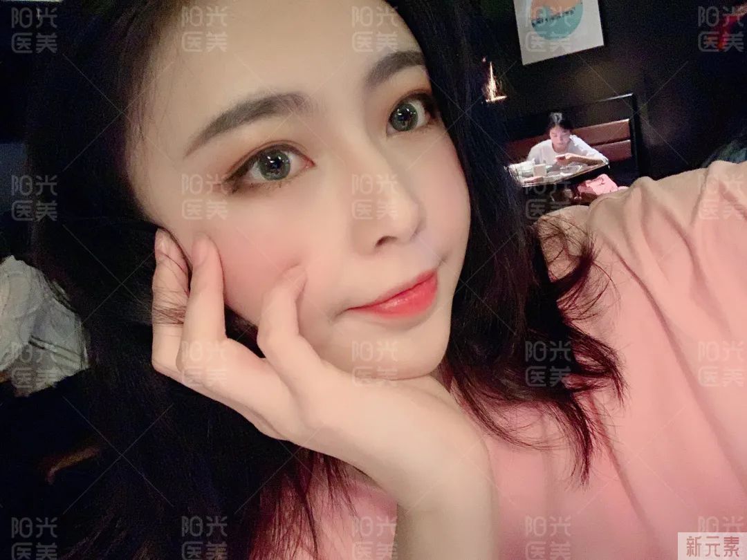 耐老脸的几个特征，你都有吗? 图片-7