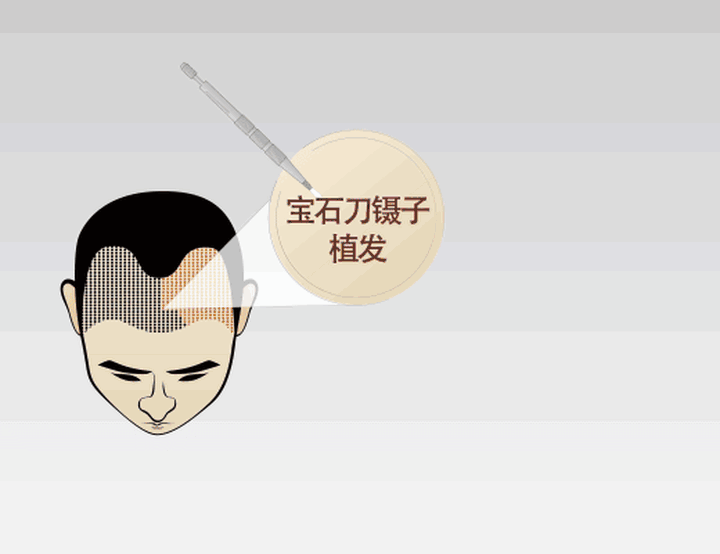 整形无小事丨男人进整形医院，并不仅仅是做这件事~ 图片-10
