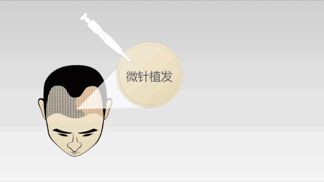 整形无小事丨男人进整形医院，并不仅仅是做这件事~ 图片-11