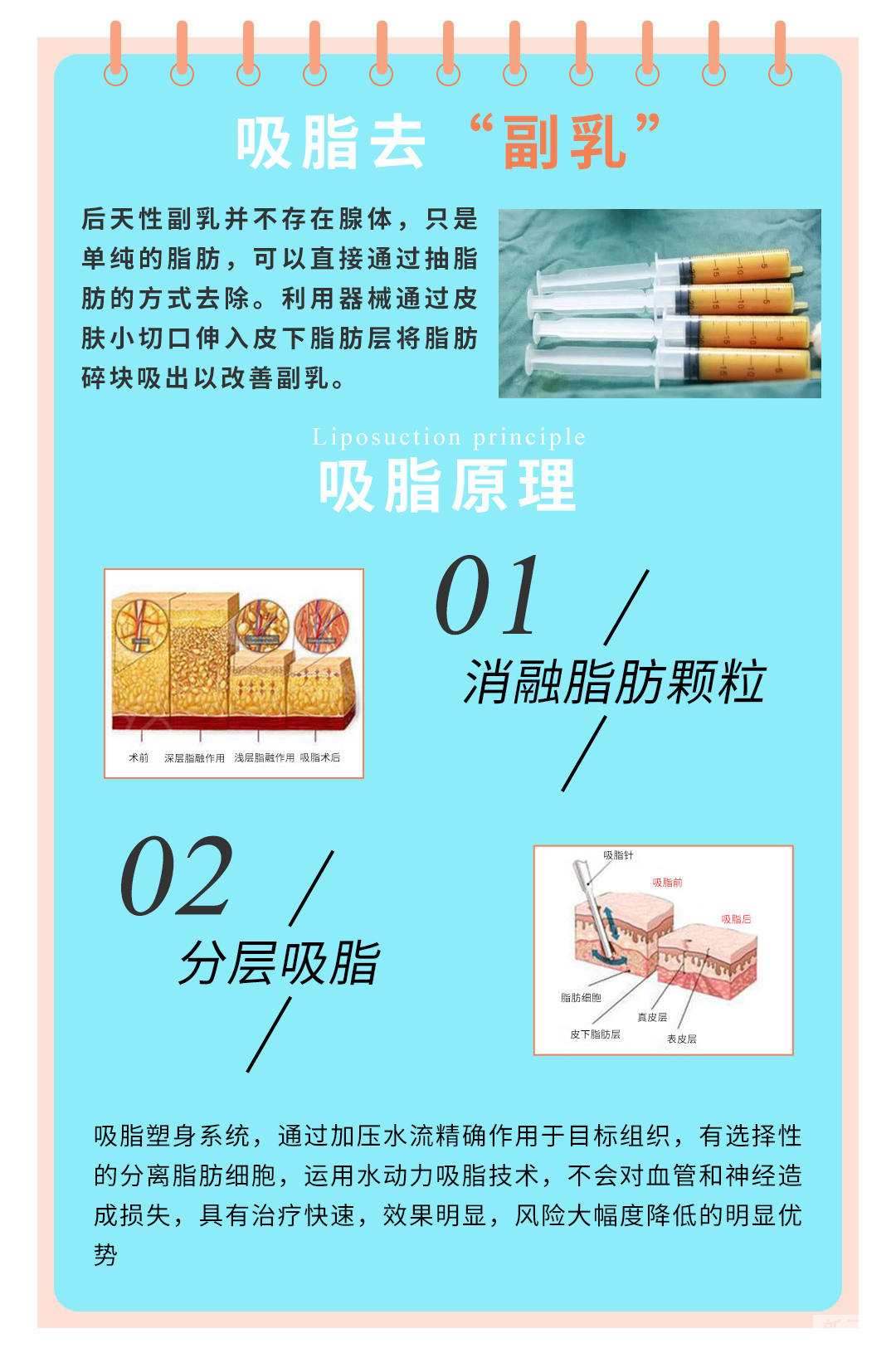 想要切除副乳又怕痛?你还可以选择—— 图片-7