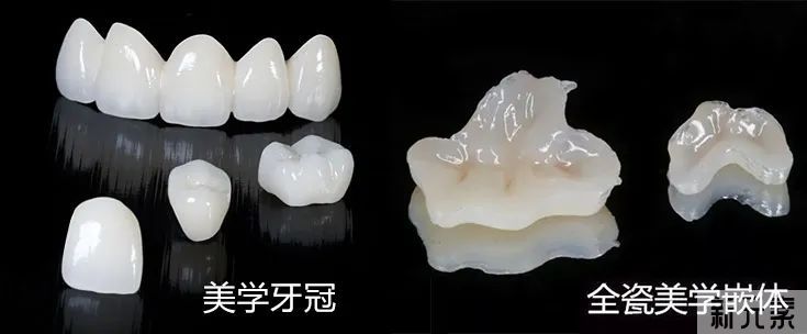 做完根管治疗后，该如何保护牙齿呢? 图片-2