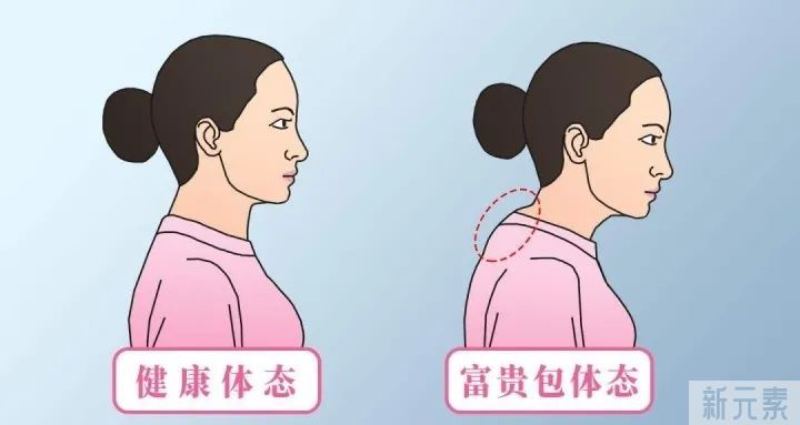 如何有效消除“富贵包”，选对方法很重要 图片-5