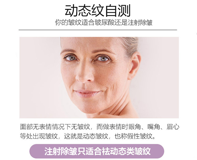你的皱纹适合注射除皱吗? 图片-4