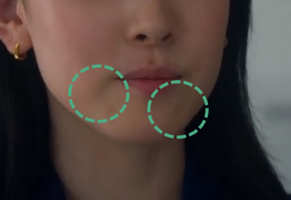 显老元凶嘴角嘟嘟肉如何解决 图片-2