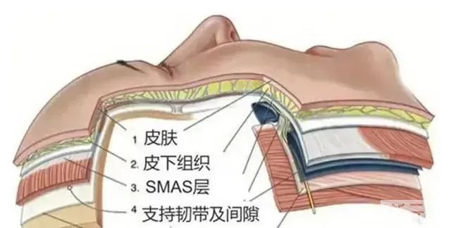 显老元凶嘴角嘟嘟肉如何解决 图片-9