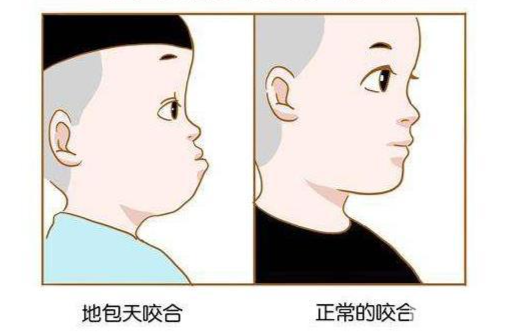 科普来了 | 孩子换牙时常舔牙会令牙长歪吗? 图片-13