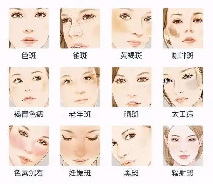 做好5个关键点，让你跟激光“反黑”说拜拜!! 图片-4