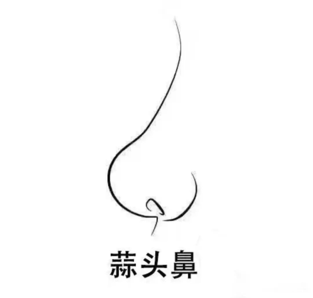 鼻梁又塌又短、鼻头粗大外翻，缺点集中的鼻子如何变美? 图片-7